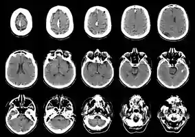 Dr Jahangir Kabir CT Scan