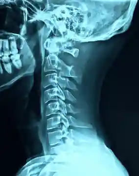 Dr Jahangir Kabir X-Ray